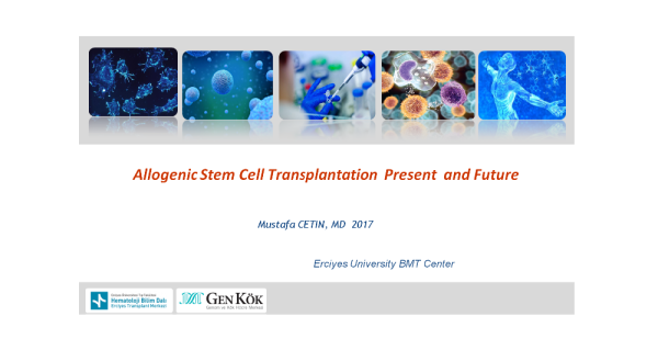 Allogenic Stem Cell Transplantation  Present  and Future (2017)