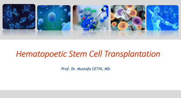 Hematopoetic Stem Cell Transplantation