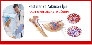 HASTALAR VE YAKINLARI İÇİN AKUT MYELOBLASTİK LÖSEMİ