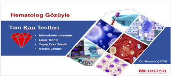 Tam Kan Testleri